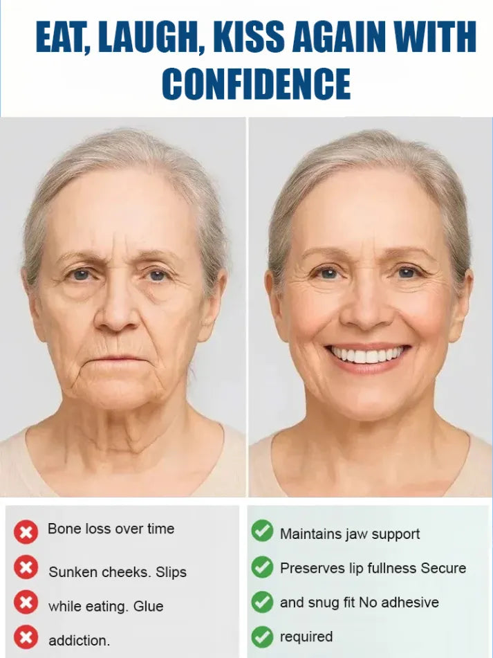 Functional Complete Dentures